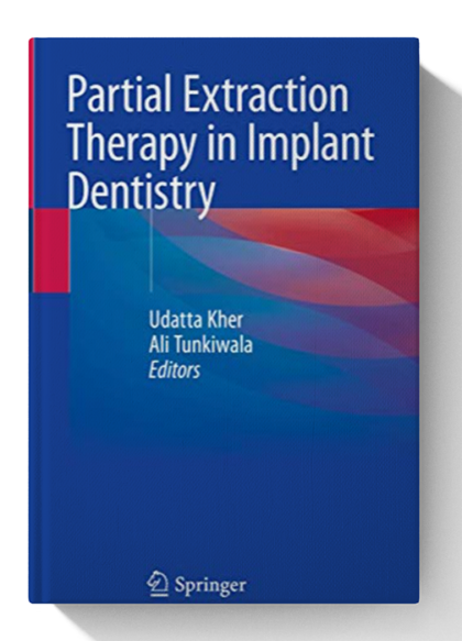 Partial Extraction Therapy in Implant Dentistry