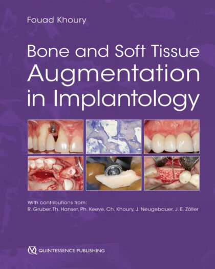 Bone and Soft Tissue Augmentation in Implantology