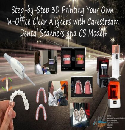 Step-by-Step 3D Printing Your Own In-Office Clear Aligners