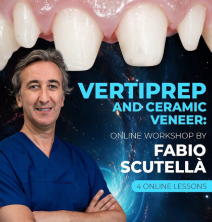 Vertical Preparation and Ceramic Veneers