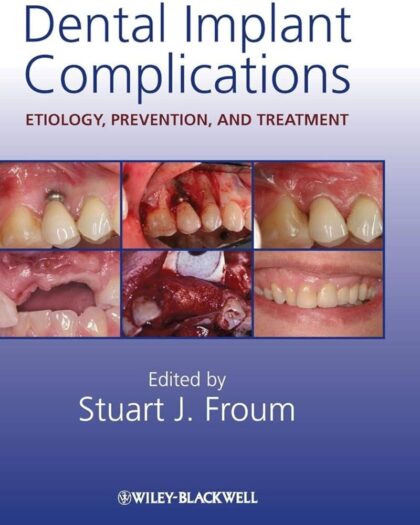 Dental Implant Complications: Etiology, Prevention, and Treatment