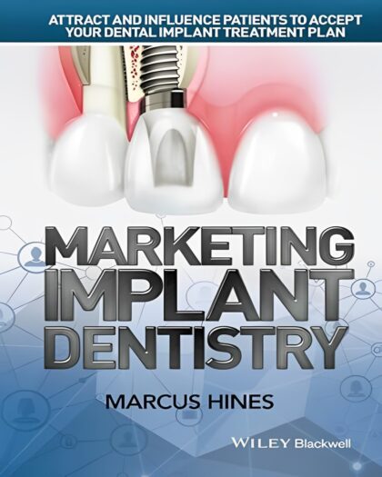Marketing Implant Dentistry: Attract and Influence Patients to Accept Your Dental Implant Treatment Plan