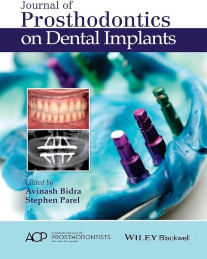 Journal of Prosthodontics on Dental Implants